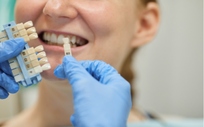 Everything You Need to Know About Dental Implants
